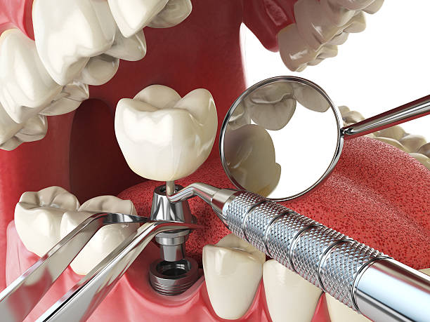 Best Urgent Dental Care  in Marissa, IL